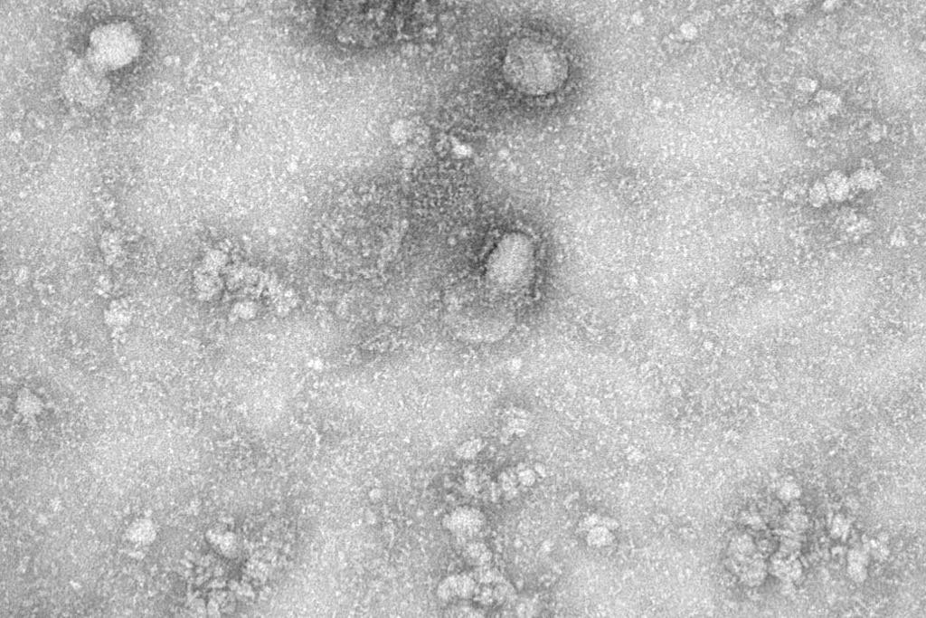 coronavirus saude