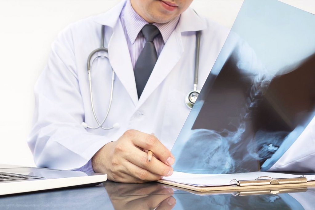 doutor analisando exame radioterapia