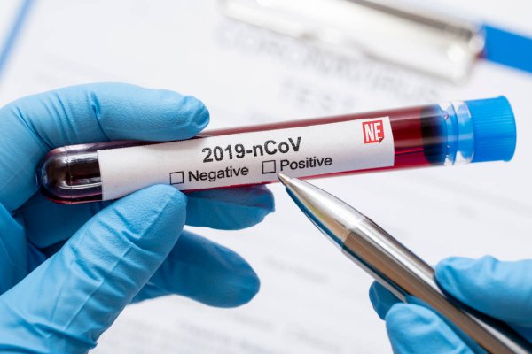 covid coronavirus positivo