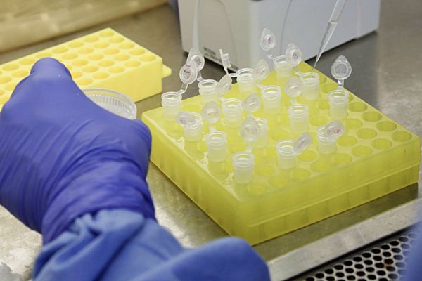 Laboratório Lacen, de Sergipe, monitora gripe no estado