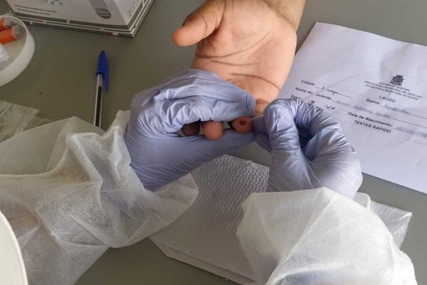 teste covid coronavirus
