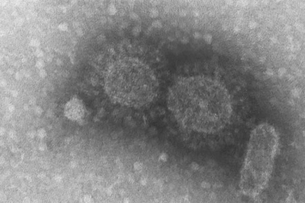 virus coronavirus sequencia genetica