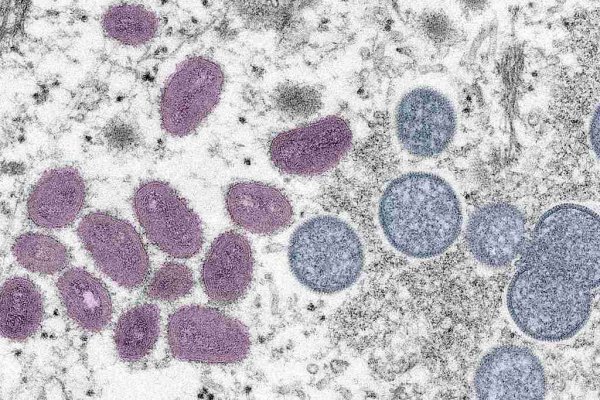 monkeypox variola virus