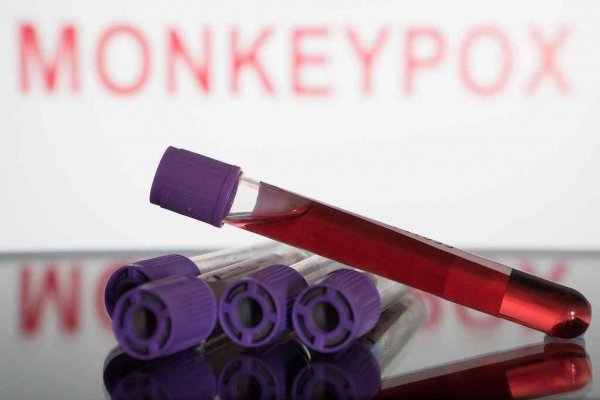 variola macaco monkeypox
