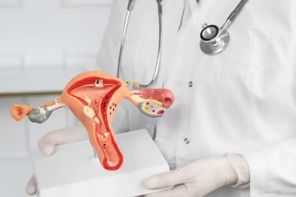 Endometriose é uma doença crônica que se caracteriza pelo crescimento de tecido endometrial fora do útero.