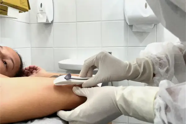 Inserção do implante subdérmico contraceptivo Implanon pelo SUS
